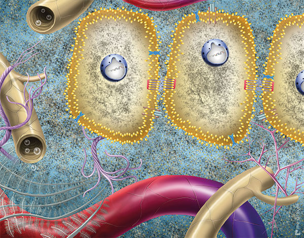 Kaputte Zellen vor Ultraschall Behandlung