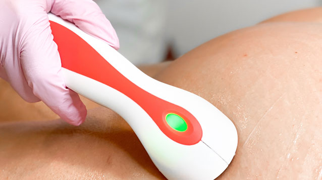 cellulite-schritte-2