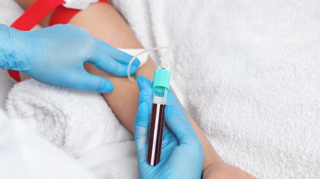 haarwachstumstherapie-schritte1