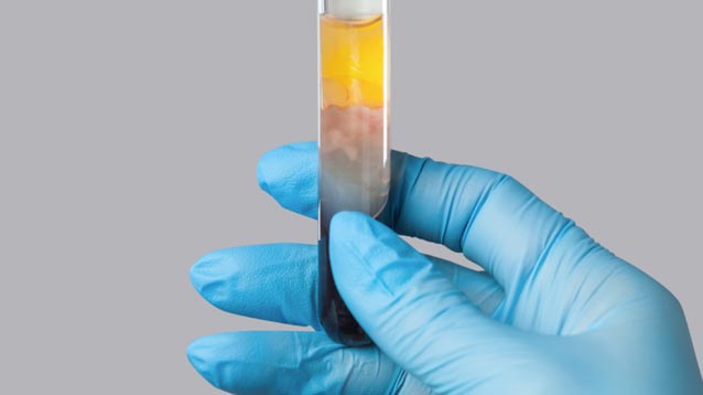 haarwachstumstherapie-schritte2