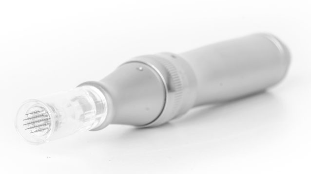 dehnungsstreifen-schritte-2