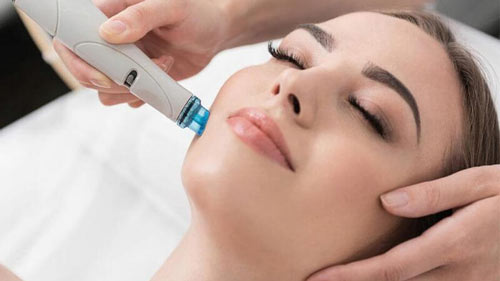 Die vier Schritte einer HydraFacial-Behandlung