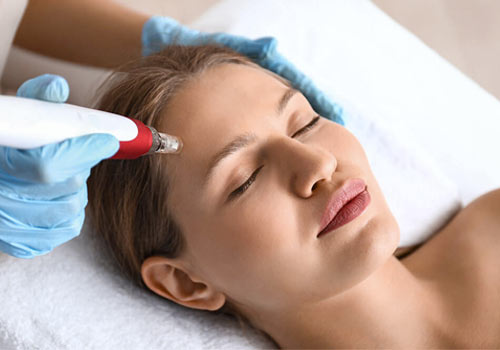 Microneedling Schulung