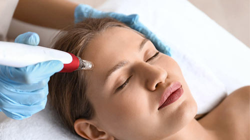 Übersicht Microneedling Schulung