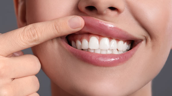 Gummy-Smile-Behandlung Schritte