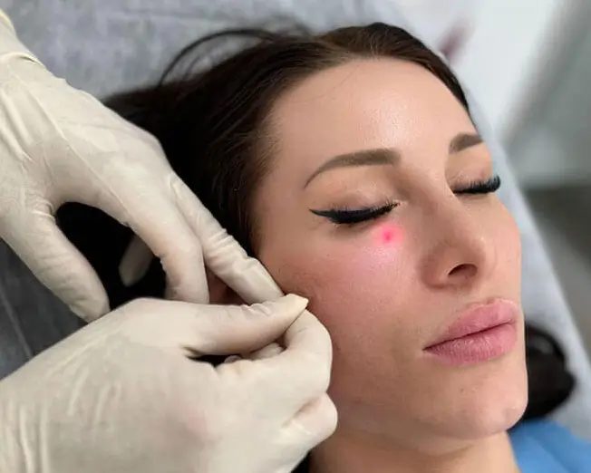 Endolift Behandlung in Frankfurt zur Hautstraffung und Konturierung ohne Operation