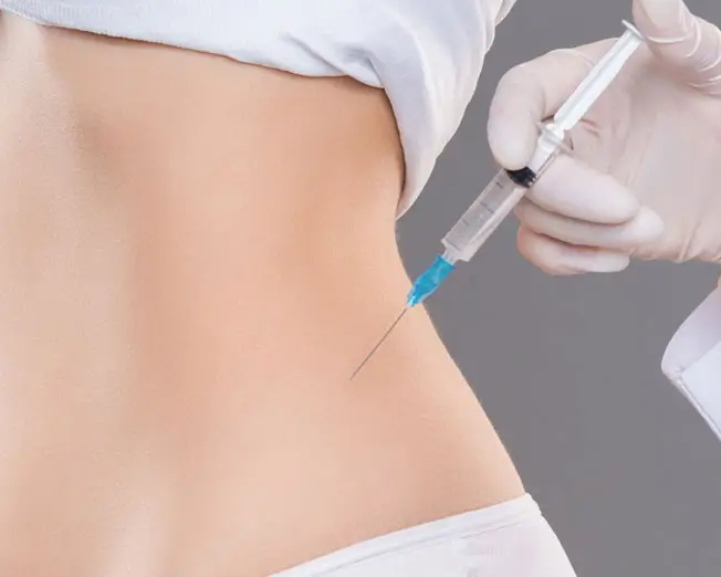 Injektionslipolyse bzw. Fett-Weg-Spritze zur gezielten Reduktion kleiner Fettdepots ohne Operation